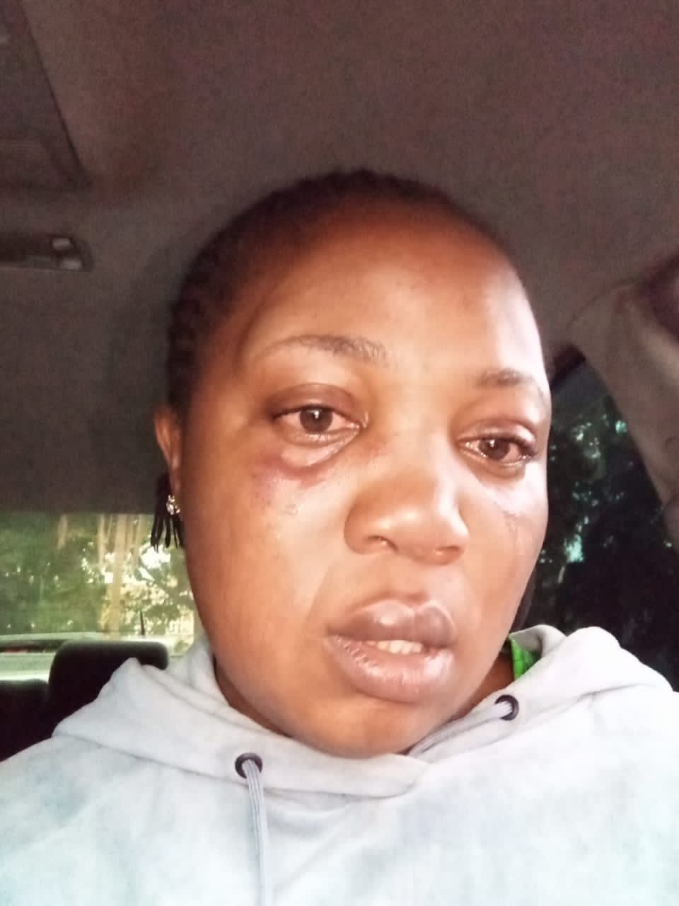 Actress turns GBV trauma into powerful tool for advocacy