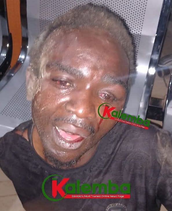 Chilenje mob ‘kills’ serial women attacker linked to Ruth Mbandu murder