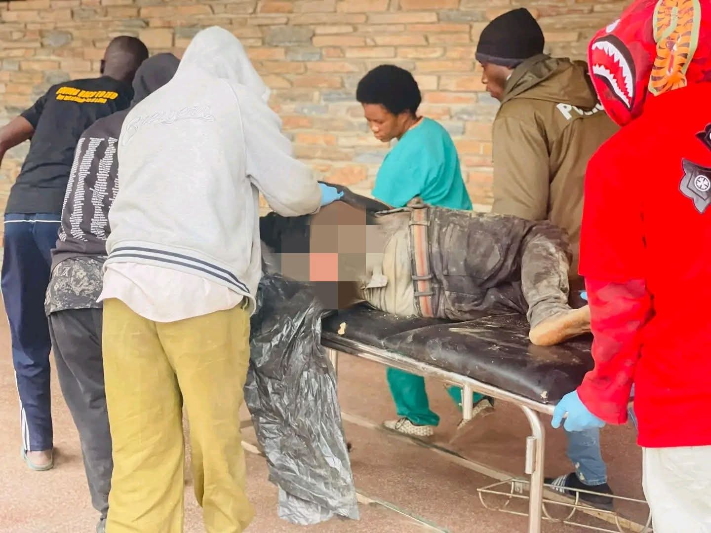 Lilanda man burns friend alive after fight, victim later dies in hospital